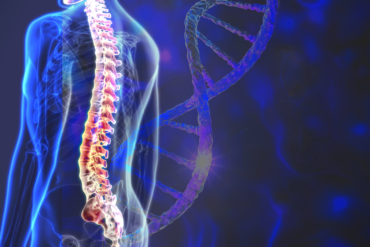 Optimizing Outcomes For Adults With Spinal Muscular Atrophy Patient